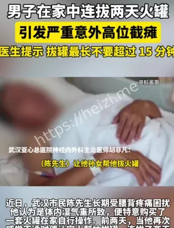 拔罐超时强负压风险科普